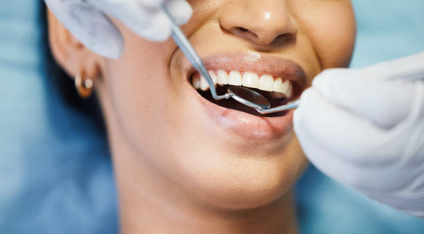 Best Emergency Treatment for Dental Infections or Abscesses in Huntingtown, MD